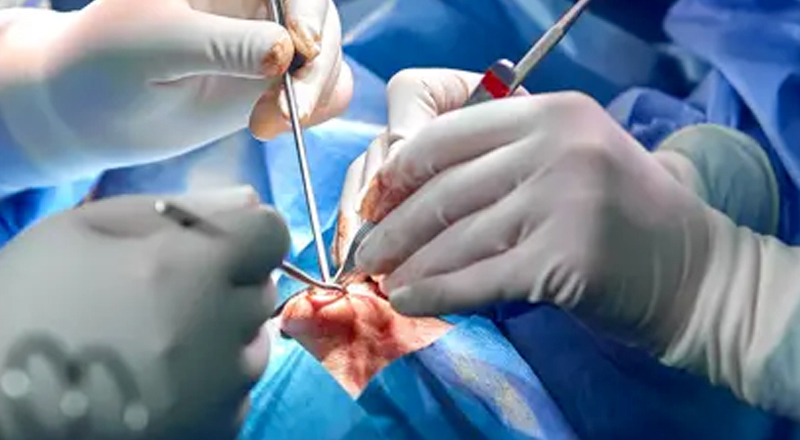 Microvascular Free Flap Reconstruction