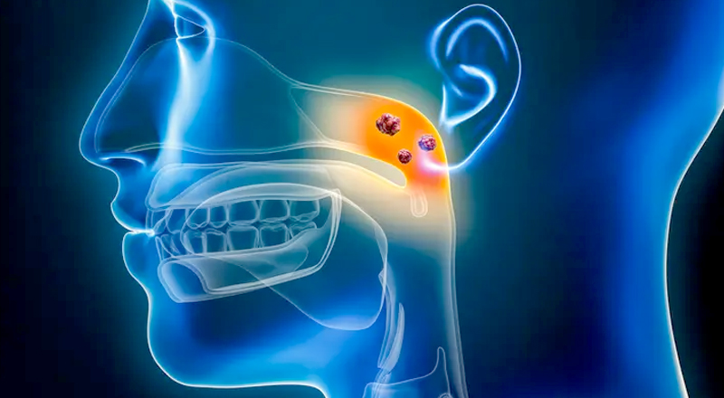 Nasopharyngeal Tumor Treatment