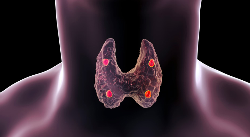 Parathyroid Surgery