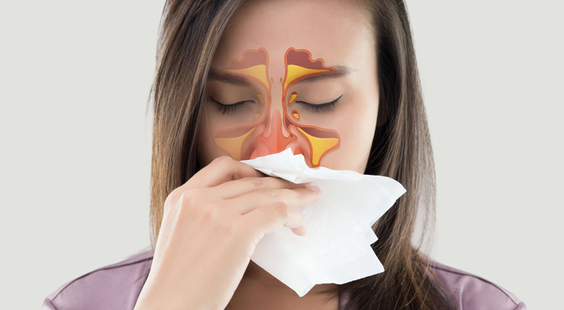 Sinus & Nasal Cavity Tumor Surgery
